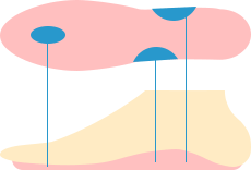 一般的なインソールの特徴 イメージ図