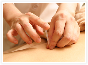 鍼灸治療 イメージ写真